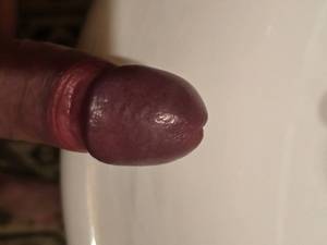 Penis 5