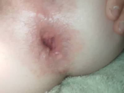 Anal,dildax2 1